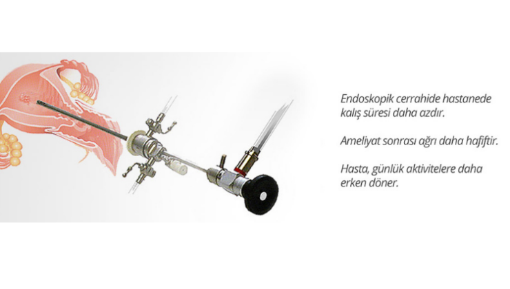 Endoskopik cerrahi ve avantajları