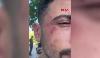 Diş Hekimine Saldırı: Komşusunun Muşta ile Darbettiği Hekim Hastaneye Kaldırıldı