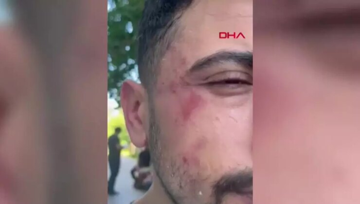 Diş Hekimine Saldırı: Komşusunun Muşta ile Darbettiği Hekim Hastaneye Kaldırıldı