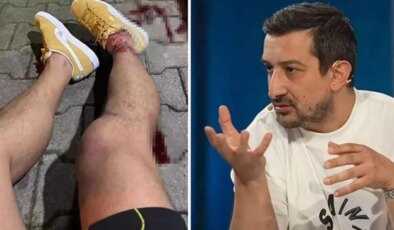 Serhat Akın’a düzenlenen silahlı saldırıdaki tüm şüpheliler yakalandı