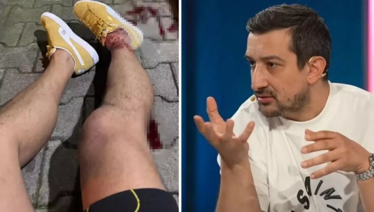 Serhat Akın’a yapılan saldırıda yeni gelişme: 6 şüpheli adliyeye sevk edildi