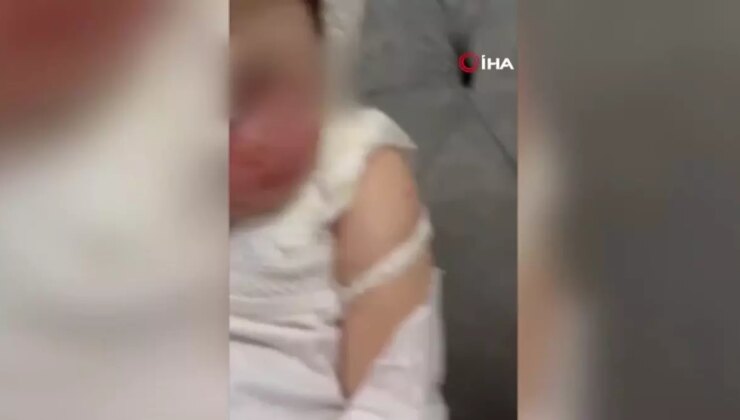 Adana’da Kreşte Kahveyle Yanık Olayı: Aile İhmal İddiasıyla Şikayetçi