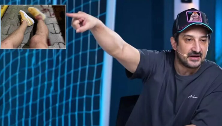 Ayaklarından vurulan Serhat Akın, Türkiye’yi terk ediyor