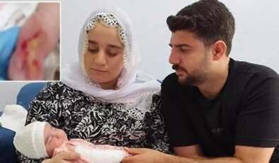 Kuvöze alınan 5 günlük bebeğin kolu yandı
