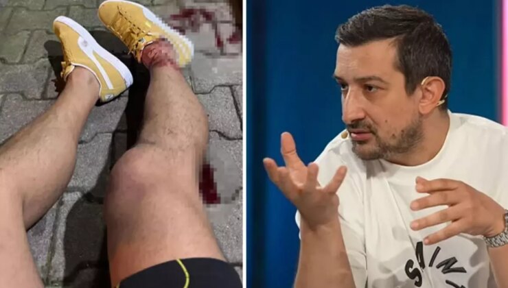 Silahlı saldırıya uğrayan Serhat Akın, Türkiye’yi terk ediyor